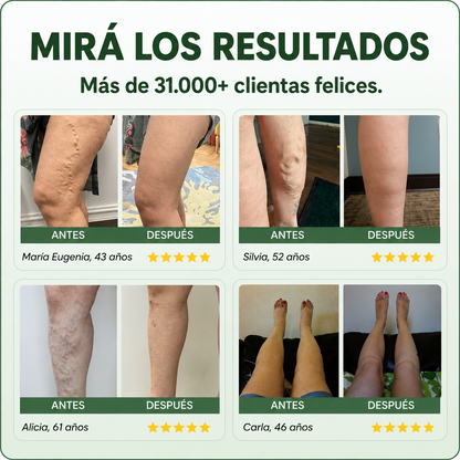 Balsamo botánico para piernas - Vital Lab